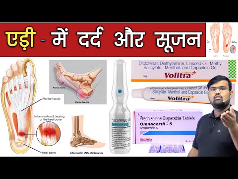 Heel Pain - एड़ी में दर्द और सूजन | Medicine | Medicine Knowledge | Treatment | Pharmacy | Doctor