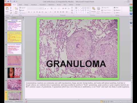 Medical School Pathology, 2013 Season, Session #16: Infectious Diseases II