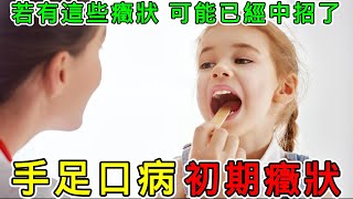 【健康】手足口病初期症状有哪些？手足口病是什麼原因引起的？#健康 #養生 #科普 #涨知识 #知識