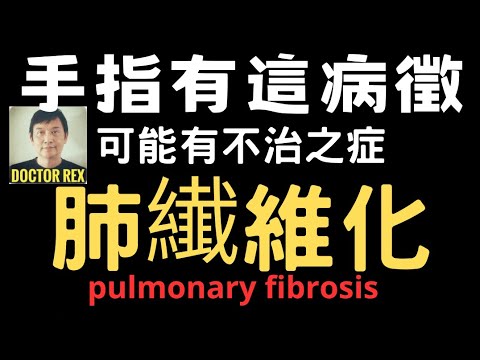 肺部纖維化: 要留意手指這些變化！及早發現才能控制病情！ hand signs of lung fibrosis