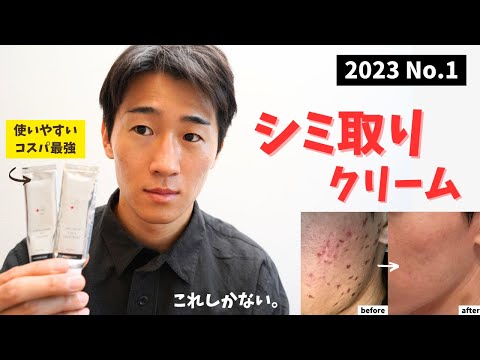 【2023】1番おすすめできるシミ取りクリーム！シミ・色素沈着・ニキビ跡に最もコスパがいいクリームとは？