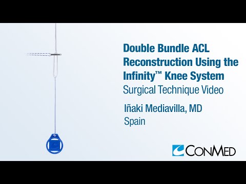 Dr. Iñaki Mediavilla - ACL Reconstruction Using the Infinity™ Knee System - Surgical Technique