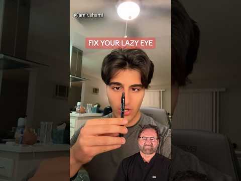 FIX YOUR LAZY EYE Surgeon Reacts