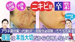 金の部屋【クレーターニキビ肌卒業】皮膚科治療・内服薬で改善できた方法を医師が解説【アクネ菌対策治療＆ピーリング＆保湿】西川礼華医師