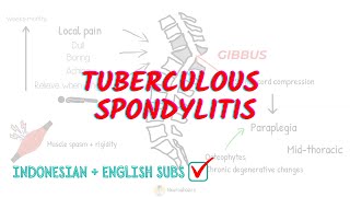 Tuberculous Spondylitis: Overview and Treatment