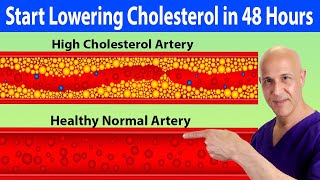 Start Lowering Your Cholesterol Naturally Within 48 Hours!  Dr. Mandell