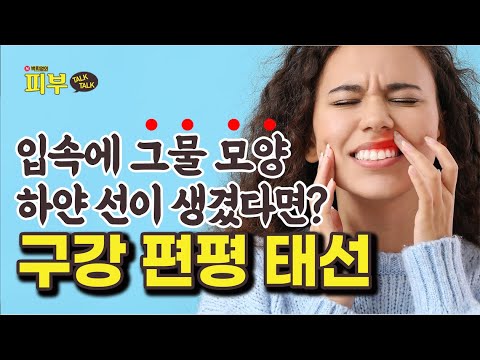 구내염이 아니다?! 입속 통증 일으키는 '구강 편평 태선' 치료법은? - 박치영의 피부 톡톡 #141