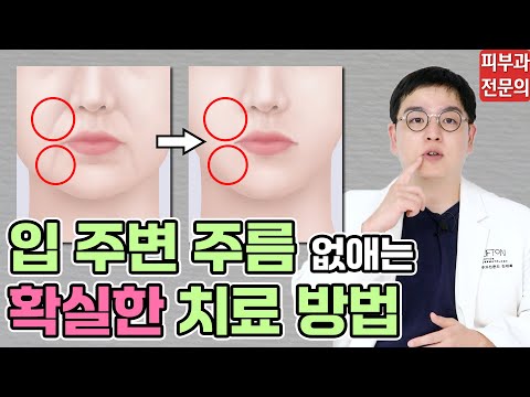 '이 방법'으로 얼굴 노화 10년 막을 수 있습니다｜피부과 전문의가 알려주는 '입 주변 주름' 종류별 치료 방법