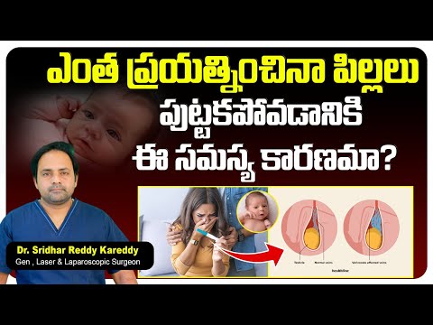 Causes of Varicocele || Varicocele Symptoms and Treatment || Varicocele in Telugu || TRH