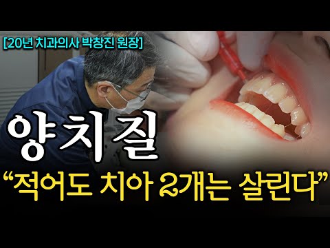 "치석 싹 녹아내린다." 평생 치과에 돈 안 써도 되는 최고의 양치질 방법 (박창진 원장 1부)