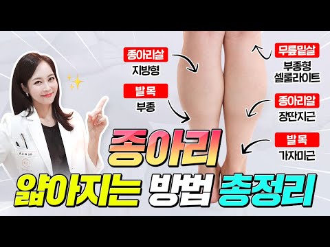 종아리 얇아지는 방법 총정리❗ 이렇게 하니까 날씬해졌어요👀 종아리 알 빼기, 종아리 알 푸는법, 종아리 알 빼는 운동, 종아리 스트레칭, 종아리 보톡스