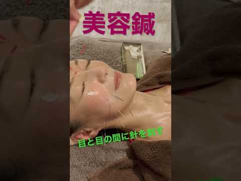 【美容鍼】眼の間に鍼入#shorts #美容鍼#cosmetic acupuncture