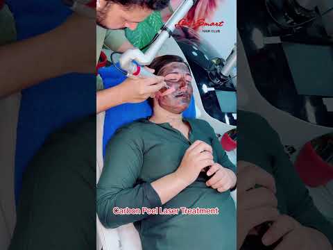 Carbon Peel Laser #laserhairtreatment #viralvideo #beauty