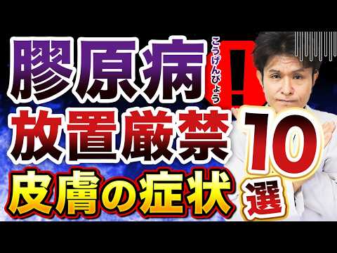 膠原病の皮膚症状を徹底解説！皮膚症状で早期発見を