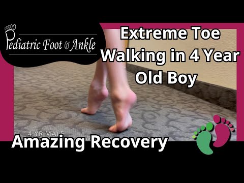 4-Year-Old Boy Undergoes Achilles Tendon Surgery for Severe Toe Walking