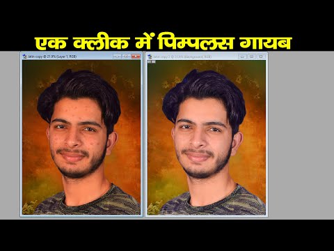 3 सेकंड में दाग धब्बे पिम्पल्स को हटाए | Removes blemishes and pimples in 3 seconds | Sk Photos