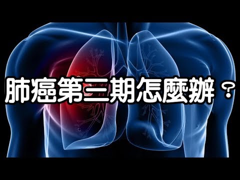 肺癌第三期怎麼辦？醫師圖文解說