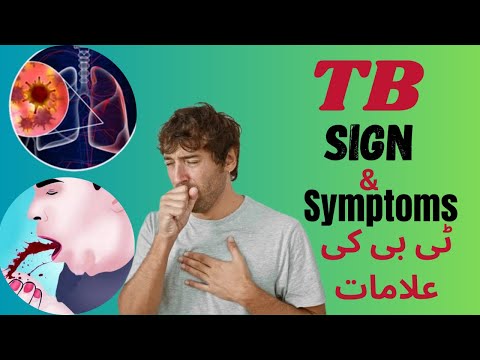 The 5 Most Common TB Signs You Should Never Ignore