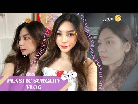 MY PLASTIC SURGERY EXPERIENCE (Facial contouring, Rhinoplasty, Double Eyelid Surgery)