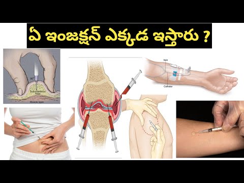 Types of Injections in Telugu ( IV, IM , SC, Intradermal Injection)