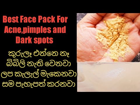 Best face pack for acne,pimples and dark spots /Remove acne ,dark spots /Skin brightening face pack