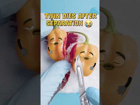 Paprika Foodsurgery ENDS TRAGIC😭💔 - CONJOINED TWINS Separation #fruitsurgery #shorts #baby