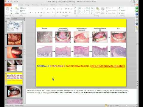 Medical School Pathology 2012 Session 051 ENT.mp4