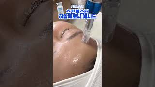 물광 피부 원한다면🤗🤗스킨부스터 |  MTS  홈케어 | mts 롤러 | #피부재생 #스킨부스터 #히알루로닉