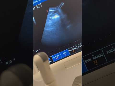 We have PUPPIES COMING! Day 20 Frenchie Ultrasound #frenchie #puppy #viral #ultrasound #pets