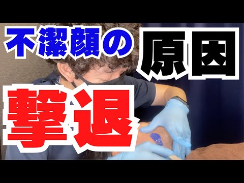 【施術動画】清潔感を台無しにする根源を撃退する方法【ワックス脱毛】