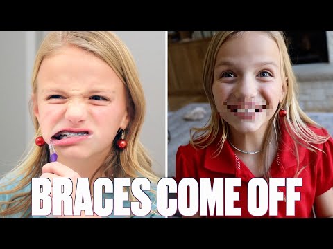 NINE-YEAR-OLD GETS BRACES OFF FOR THE FIRST TIME | BEFORE AND AFTER BRACES