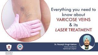 What is EVLT: Endovenous Laser Treatment | Varicose Veins Treatment