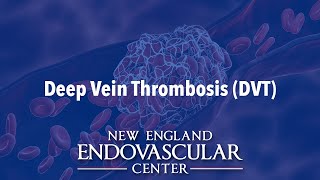 DVT - Deep Vein Thrombosis