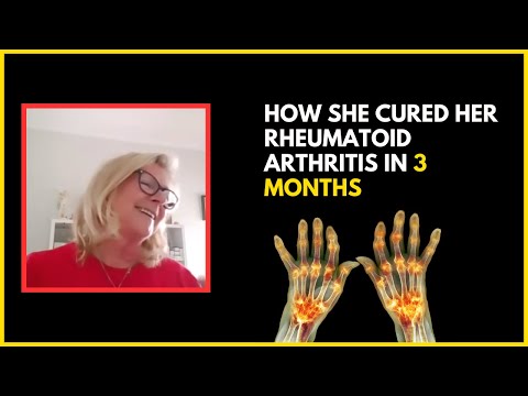 Rheumatoid Arthritis *almost* Cured In 3 Months