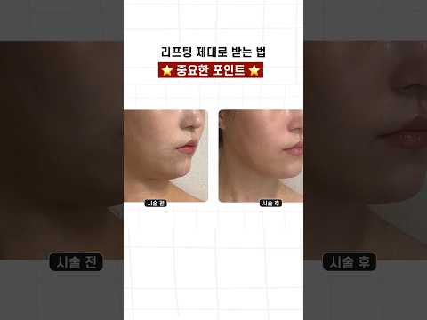 2️⃣ 인모드 이거 알고 받아야 효과 나옵니다 #실제후기