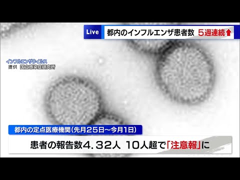 都内のインフルエンザ患者が5週連続で増加中　基本的な感染対策やワクチン接種の検討も呼びかけ