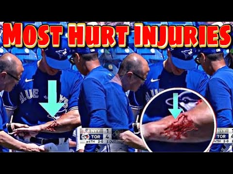 MLB | Slick Injuries V10