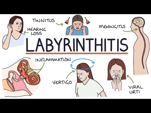 Understanding Labyrinthitis