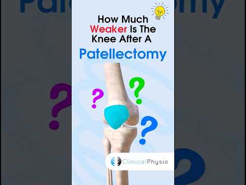 Patellectomy #anatomy #Patellectomy #kneesurgery #kneesurgeryrecovery #patella #knee #physio