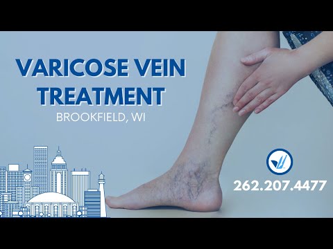 Our Vein Treatment Center in Brookfield, WI