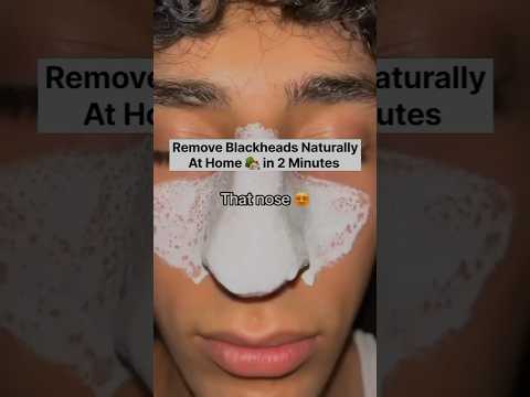 Remove black heads naturally #shorts #blackheads #deadskin #viral #diy #skinbeauty