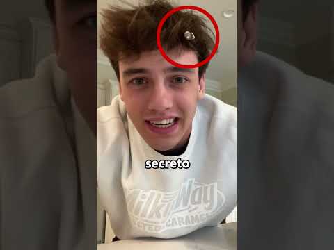 Cómo quitarse el CHICLE del cabello 👏