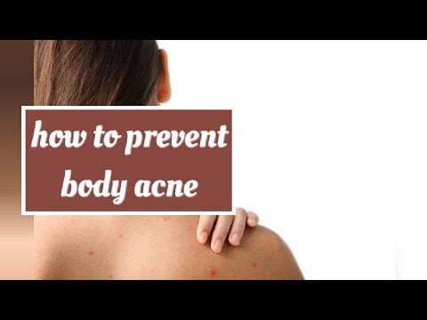 How to Prevent Body Acne and How to Correct it #skincare! Skincare information