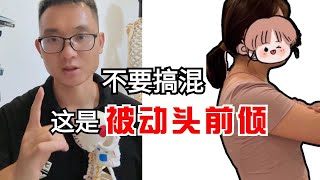 这是被动头前倾，不要搞混