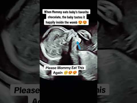 when mommy eats chocolate during pregnancy #babyultrasound #baby #pregnancyscan