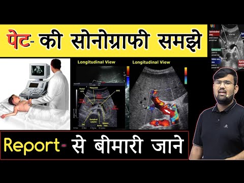 USG - सोनोग्राफी | Ultrasound | Ultrasound Report | Abdomen Ultrasound | Doctor | MBBS | BHMS | BAMS