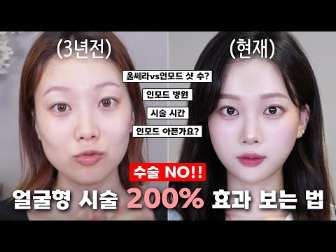 How to get a pretty face without surgery (How to get 200% in-mode laser effect)