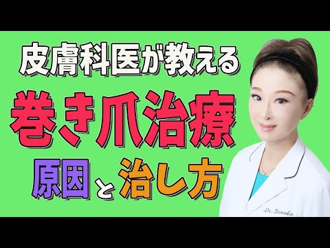 【巻き爪 治し方】巻き爪治療 原因と治し方を皮膚科医が教えます！