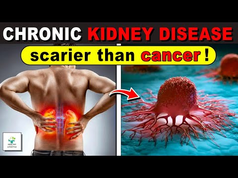 👉Why chronic kidney disease is more frightening than cancer!  - Healthy lifestyle