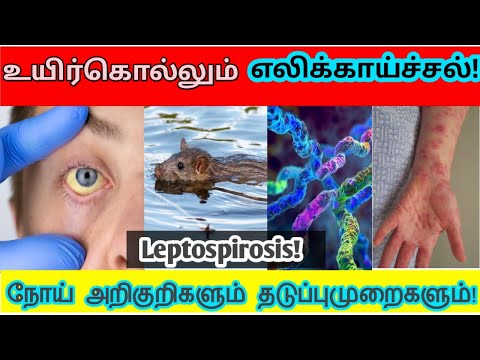 எலிக்காய்ச்சல் | leptospirosis explained in tamil | leptospira symptoms in tamil | leptospirosis